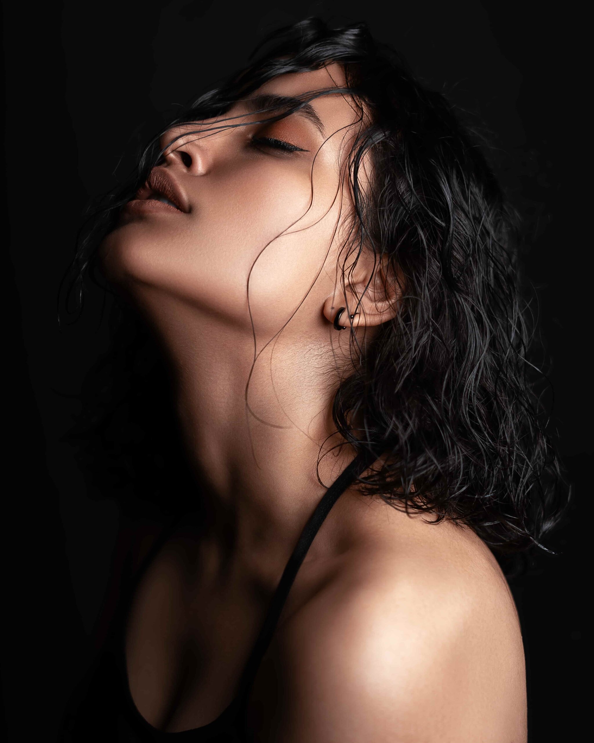 Jawline filler New Age Aesthetics Ottawa